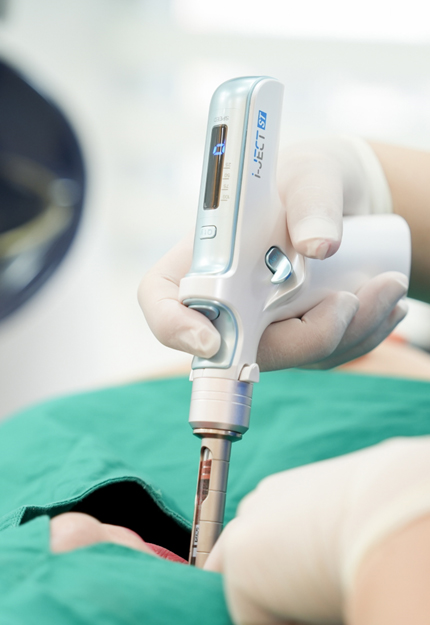 통증경감시스템